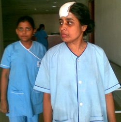 Brain Tumor, Astrocytoma II, a Lady from Tripura. Good Recovery Full Head shaving not necesary for Brain Surgery
